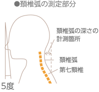 ●頚椎弧の測定部分,頚椎弧の深さの計測箇所,頚椎弧,第七頸椎
